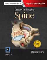 9780323377058-032337705X-Diagnostic Imaging: Spine