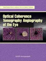 9781630912826-1630912824-Optical Coherence Tomography Angiography of the Eye: OCT Angiography