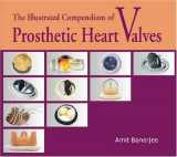 9788171883349-8171883346-The Illustrated Compendium of Prosthetic Heart Valves