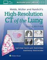 9781975144432-1975144430-Webb, Müller and Naidich's High-Resolution CT of the Lung