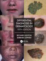 9780367085988-0367085984-Differential Diagnosis in Dermatology