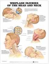 9781587793752-158779375X-Whiplash Injuries of The Head and Neck Anatomical Chart