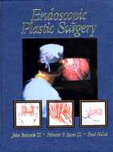 9780942219654-0942219651-Endoscopic Plastic Surgery