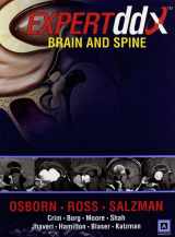 9781931884020-1931884021-Expertddx: Brain and Spine