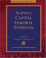 9780892032860-0892032863-Slipped Capital Femoral Epiphysis (Monograph Series)