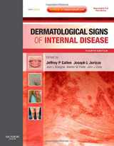 9781416061113-1416061118-Dermatological Signs of Internal Disease: Expert Consult - Online and Print