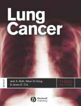 9781405151122-1405151129-Lung Cancer