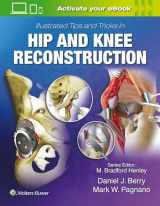 9781496392060-149639206X-Illustrated Tips and Tricks in Hip and Knee Reconstructive and Replacement Surgery