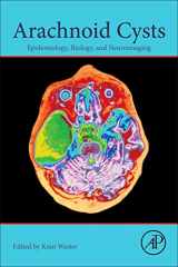 9780128099322-0128099321-Arachnoid Cysts: Epidemiology, Biology, and Neuroimaging