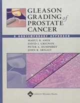 9780781742795-078174279X-Gleason Grading of Prostate Cancer: A Contemporary Approach