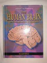 9780323011266-0323011268-The Human Brain: in Photographs and Diagrams