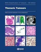 9789283245063-9283245067-Thoracic Tumours: WHO Classification of Tumours