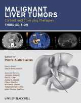 9781405179768-1405179767-Malignant Liver Tumors: Current and Emerging Therapies
