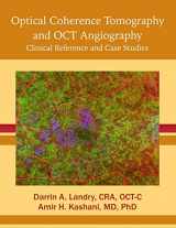 9781523976867-1523976861-Optical Coherence Tomography and Oct Angiography: Clinical Reference and Case Studies