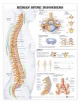 9781587793998-1587793997-ACC Human Spine Disorders Anatomical Chart