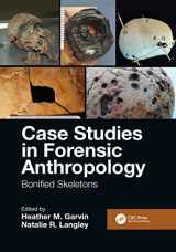 9781032086569-1032086564-Case Studies in Forensic Anthropology: Bonified Skeletons