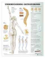 9781587797590-1587797593-Understanding Osteoporosis Chart