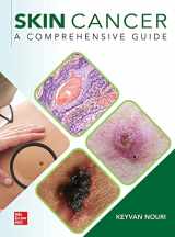 9781260453003-1260453006-Skin Cancer: A Comprehensive Guide