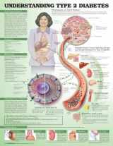 9781469894980-146989498X-Understanding Type 2 Diabetes Anatomical Chart