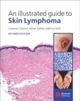 9781405113762-1405113766-An Illustrated Guide to Skin Lymphoma