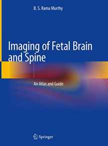 9789811358432-9811358435-Imaging of Fetal Brain and Spine: An Atlas and Guide