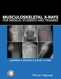 9781118458730-1118458737-Musculoskeletal X-Rays for Medical Students and Trainees