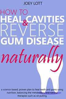 9781542565684-1542565685-How to Heal Cavities and Reverse Gum Disease Naturally: a science-based, proven plan to heal teeth and gums using nutrition, balancing the metabolism, and natural therapies such as oil pulling