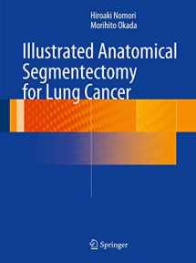 9784431541431-4431541438-Illustrated Anatomical Segmentectomy for Lung Cancer