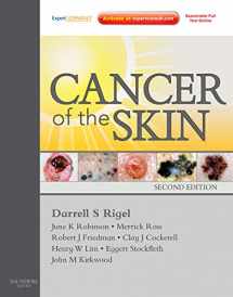 9781437717884-1437717888-Cancer of the Skin: Expert Consult - Online and Print