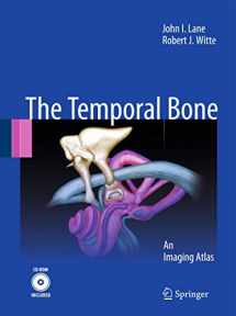 9783642022098-364202209X-Temporal Bone: An Imaging Atlas