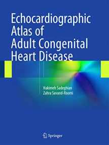 9783319129334-3319129333-Echocardiographic Atlas of Adult Congenital Heart Disease