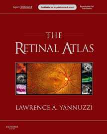 9780702033209-0702033200-The Retinal Atlas: Expert Consult - Online and Print