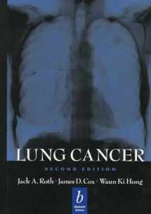 9780865425736-0865425736-Lung Cancer