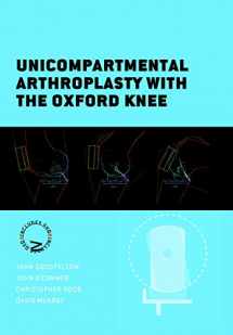 9781910158456-1910158453-Unicompartmental Arthroplasty with the Oxford Knee