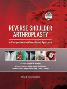 9781630916855-1630916854-Reverse Shoulder Arthroplasty: A Comprehensive Case-Based Approach