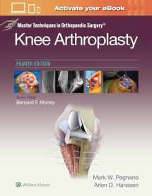 9781496315052-1496315057-Master Techniques in Orthopedic Surgery: Knee Arthroplasty (Master Techniques in Orthopaedic Surgery)