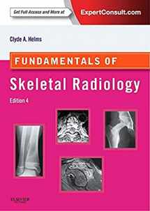 9781455751549-1455751545-Fundamentals of Skeletal Radiology