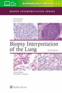 9781975136581-1975136586-Biopsy Interpretation of the Lung (Biopsy Interpretation Series)
