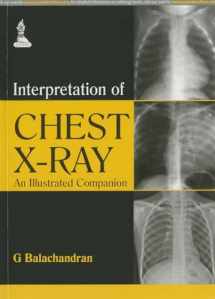 9789351521723-9351521729-Interpretation of Chest X-Ray: An Illustrated Companion