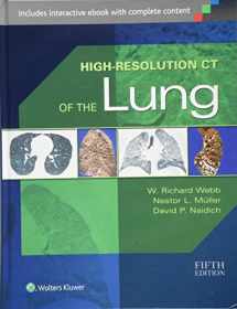 9781451176018-1451176015-High-Resolution CT of the Lung