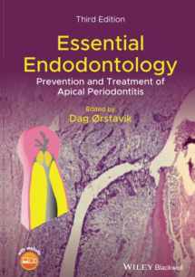 9781119271956-1119271959-Essential Endodontology: Prevention and Treatment of Apical Periodontitis