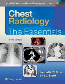 9781451144482-1451144482-Chest Radiology: The Essentials (Essentials Series)