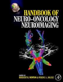 9780123708632-012370863X-Handbook of Neuro-Oncology Neuroimaging