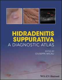 9781119272953-1119272955-Hidradenitis Suppurativa: A Diagnostic Atlas