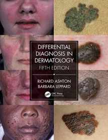 9780367085971-0367085976-Differential Diagnosis in Dermatology
