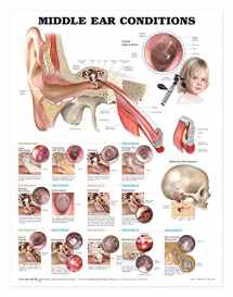 9781605470962-1605470961-Middle Ear Conditions Anatomical Chart