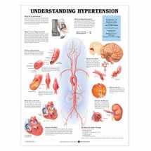 9781587799914-158779991X-Entendiendo Que ES la Hypertension/Understanding Hypertension Anatomical Chart
