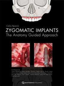9781850972259-1850972257-Zygomatic Implants: The Anatomy-Guided Approach
