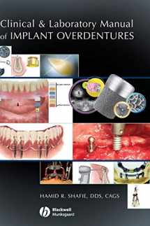 9780813808819-0813808812-Clinical and Laboratory Manual of Implant Overdentures
