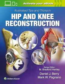 9781496392060-149639206X-Illustrated Tips and Tricks in Hip and Knee Reconstructive and Replacement Surgery